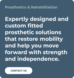 Prosthetics mobile